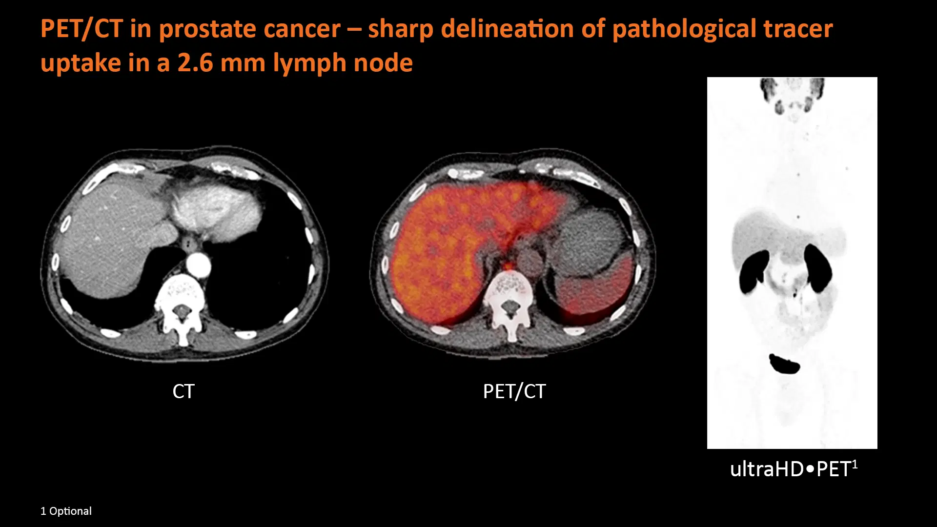 ICISi Masterclass in Imaging of Prostate Cancer 2nd Edition